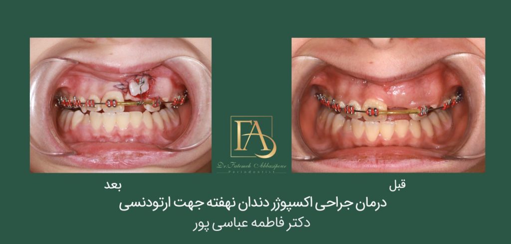 نمونه درمان ارتودنسی